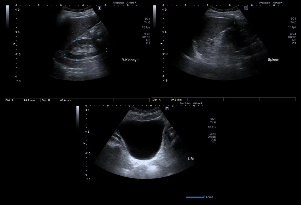 abdominal ultrasound cost in dubai