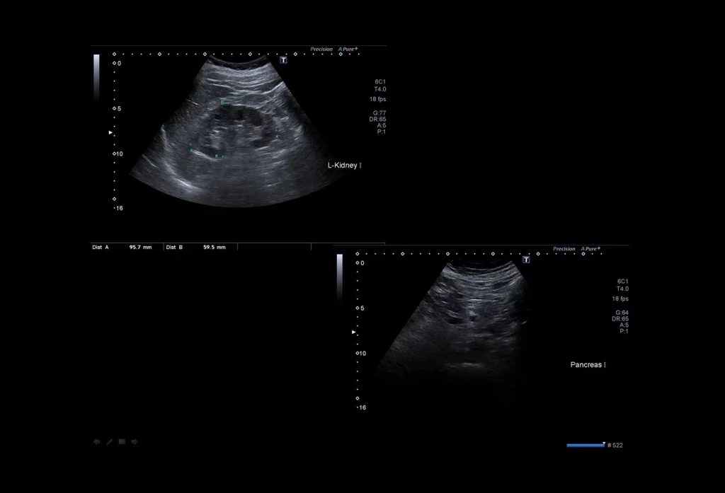 abdominal ultrasound cost in dubai