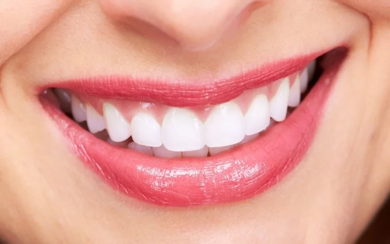 best venners in dubai